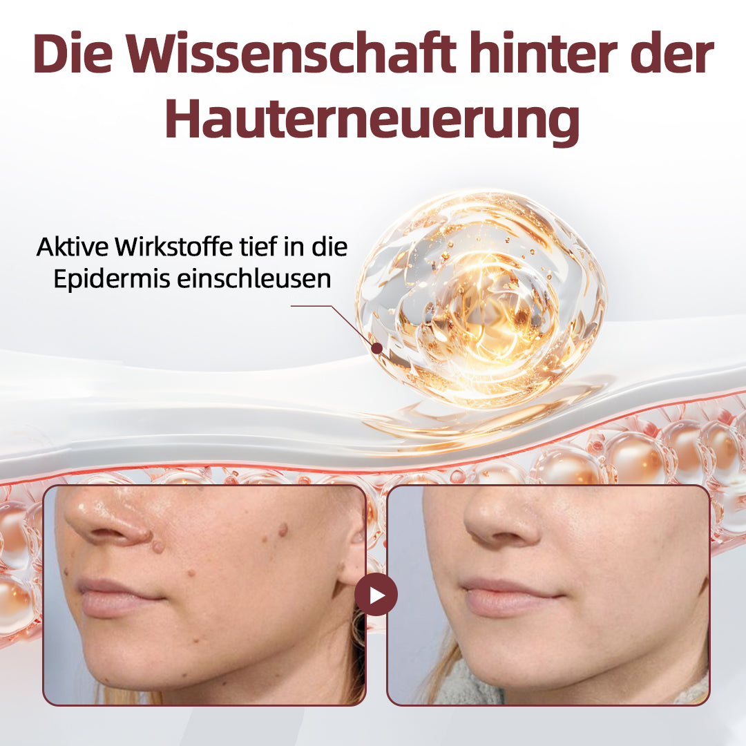 CureVivo® KeraErase Dual-Action Erneuerung Creme💎💎💎