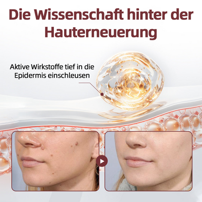 CureVivo® KeraErase Dual-Action Erneuerung Creme💎💎💎