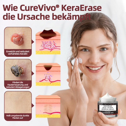 CureVivo® KeraErase Dual-Action Erneuerung Creme💎💎💎