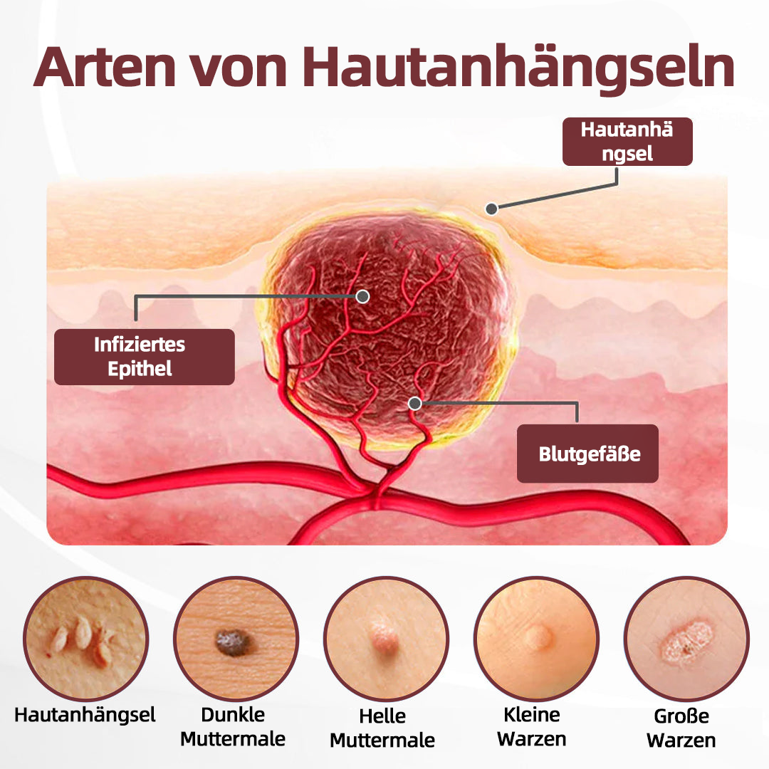 CureVivo® KeraErase Dual-Action Erneuerung Creme💎💎💎