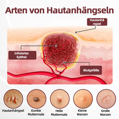 CureVivo® KeraErase Dual-Action Erneuerung Creme💎💎💎